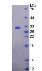 网蛋白(PLEC)重组蛋白