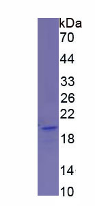 唾液酸结合Ig样凝集素14(SIGLEC14)重组蛋白