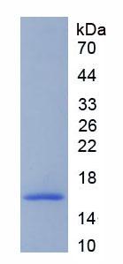脱支酶同源物1(DBR1)重组蛋白