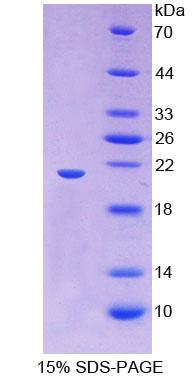 透明质酸介导运动因子受体(HMMR)重组蛋白