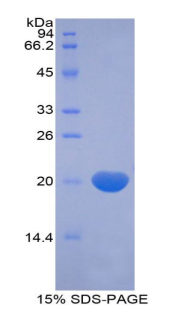 松弛素/胰岛素样肽受体1(RXFP1)重组蛋白