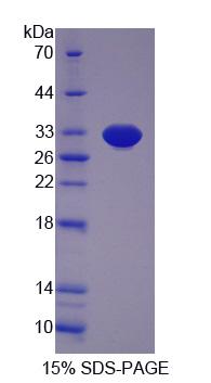 死亡诱导终结因子1(DIDO1)重组蛋白