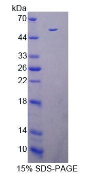 死亡关联蛋白激酶3(DAPK3)重组蛋白