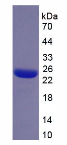 丝束蛋白3(PLS3)重组蛋白
