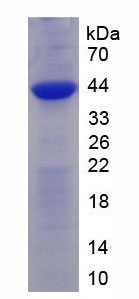 受体活性修饰蛋白2(RAMP2)重组蛋白