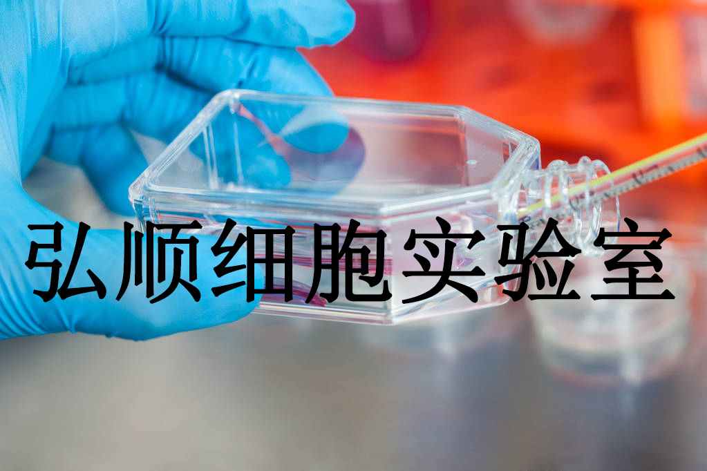 NCI-H128 Cells|人小细胞肺癌贴壁细胞