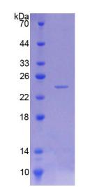 神经疾病靶标酯酶(NTE)重组蛋白