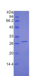 妊娠相关血浆蛋白A2(PAPPA2)重组蛋白