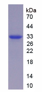 妊娠关联血浆蛋白A(PAPPA)重组蛋白