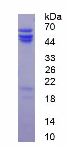 犬尿氨酸酶(KYNU)重组蛋白