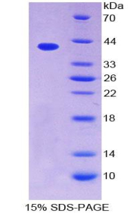 趋化因子C-C-基元配体4样蛋白1(CCL4L1)重组蛋白