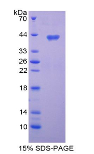 趋化因子C-C-基元配体3样蛋白1(CCL3L1)重组蛋白