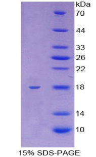 驱动蛋白家族成员5A(KIF5A)重组蛋白