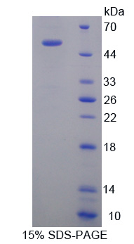 驱动蛋白家族成员18A(KIF18A)重组蛋白