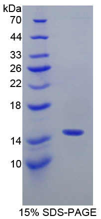 轻肽神经丝蛋白(NEFL)重组蛋白