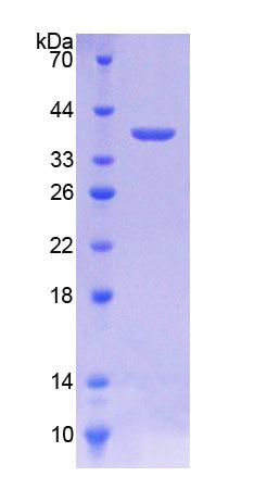 桥粒芯糖蛋白2(DSG2)重组蛋白