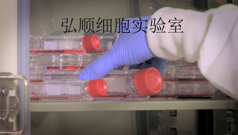 SW1222 Cells|人结肠癌贴壁细胞