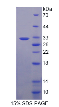 前蛋白转化酶枯草溶菌素9(PCSK9)重组蛋白