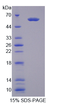 尿调蛋白样蛋白1(UMODL1)重组蛋白