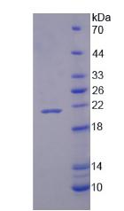 尼克酰胺腺嘌呤二核苷酸磷酸氧化酶4(NOX4)重组蛋白