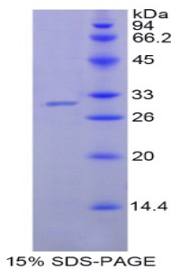 尼克酰胺-N-甲基转移酶(NNMT)重组蛋白