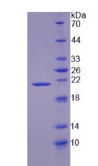 酶原粒蛋白16同源物B(ZG16B)重组蛋白