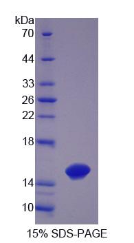 毛透明蛋白(TCHH)重组蛋白