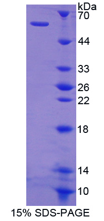 猫眼综合征染色体区候选基因1(CECR1)重组蛋白