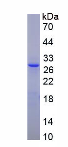 亮氨酰/半胱氨酰氨肽酶(LNPEP)重组蛋白
