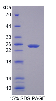 可溶性半乳糖凝集素3结合蛋白(LGALS3BP)重组蛋白