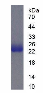 精神分裂症破坏蛋白1(DISC1)重组蛋白