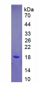 监理蛋白(SVIL)重组蛋白