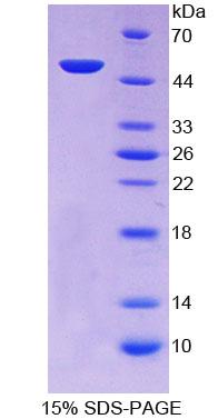 甲状腺激素受体交互子6(TRIP6)重组蛋白
