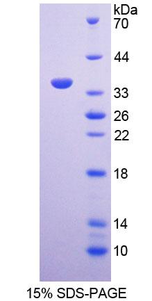 基质重塑关联蛋白5(MXRA5)重组蛋白