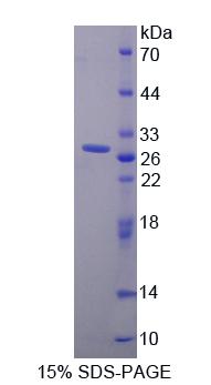 基质相互作用分子1(STIM1)重组蛋白