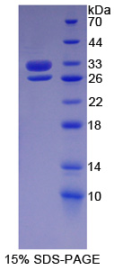 基底细胞粘附分子(BCAM)重组蛋白