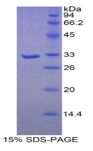 肌球蛋白重链16(MYH16)重组蛋白