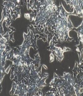 人前列腺癌细胞；22Rv1