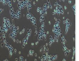 人膀胱癌细胞；5637