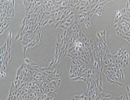 人视网膜上皮细胞；ARPE-19