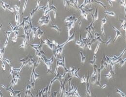 人甲状腺癌细胞；B-CPAP