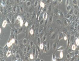 人宫颈癌上皮细胞；Ca ski