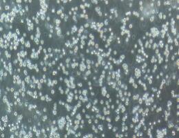 人急性淋巴细胞白血病T淋巴细胞；CCRF-CEM