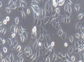 人胰腺腺泡上皮癌细胞；HPAC