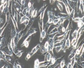 人脑胶质瘤细胞；HS683