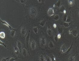 人脐静脉内皮细胞；HUVEC