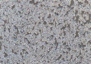 人乳腺癌细胞；MDA-MB-453