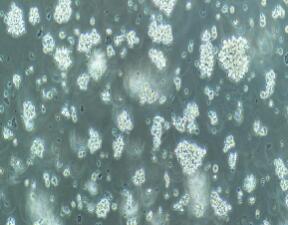 人T细胞白血病细胞；MT-4