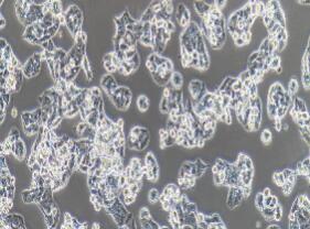 人肺腺癌细胞；NCI-H1395