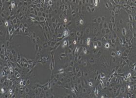 人肺支气管癌细胞；NCI-H1650